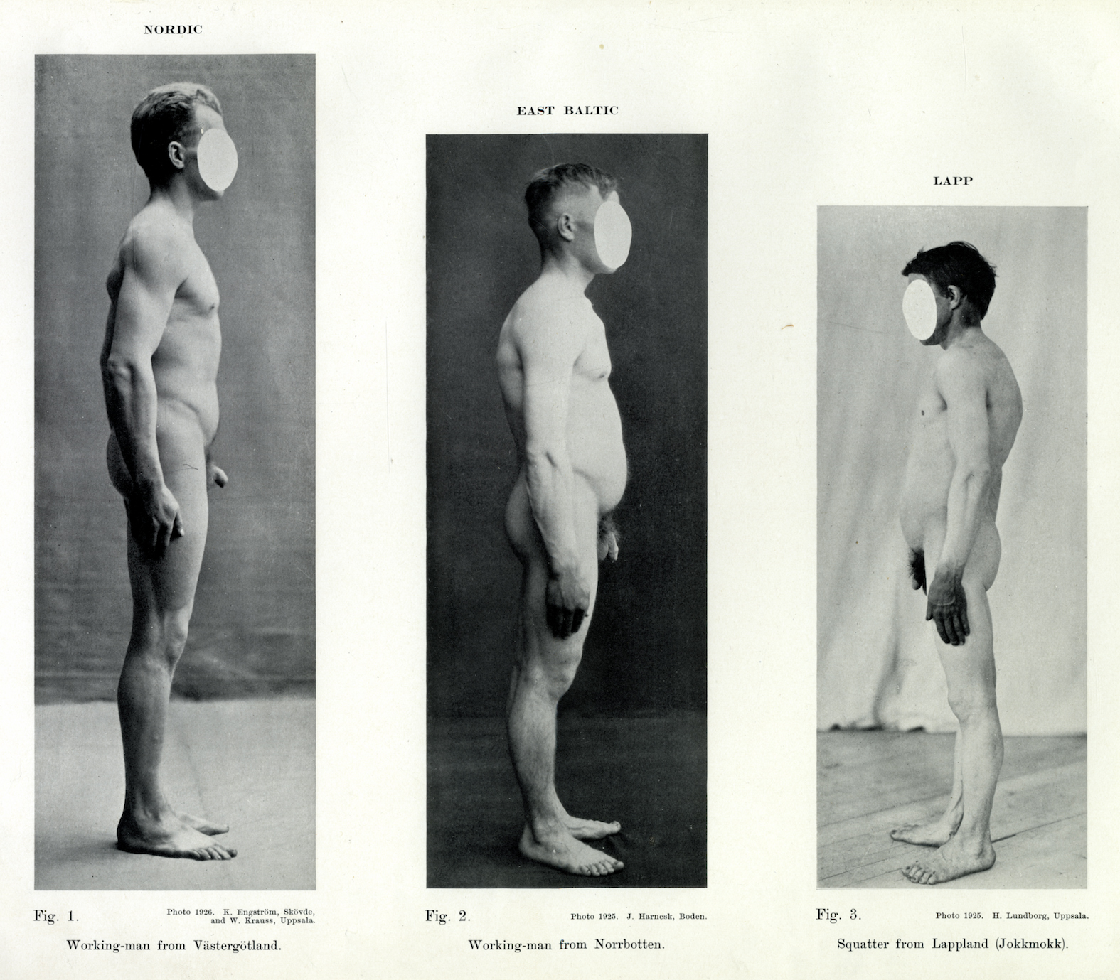 Figure1: From Herman Lundborg and F. J. Linder, The racial characters of the Swedish nation, 1926.